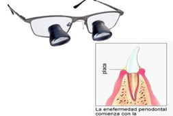 Microcirugía periodontal